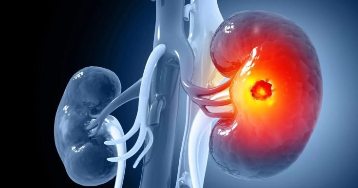 b371c3fac02541bbe1163e25436d07a3 (1)